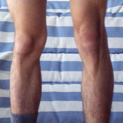 WeirdKnees.jpg